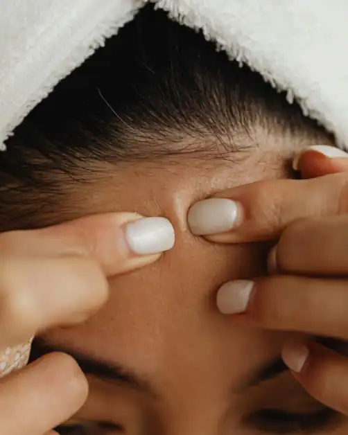 close-up of skin showing how niacinamide can help with breakouts and pores